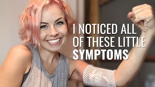 SWOLLEN LYMPH NODES to STAGE 4 Cancer  Alexandra  Hodgkins Lymphoma  The Patient Story [upl. by Aenotna97]