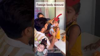 Foreign baby removal😂🤣 baby doctor family drimranpatel shorts shortsfeed short ytshorts [upl. by Audri]