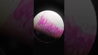 Histological slide of tongue showing filiform and fungiform papillae [upl. by Sells432]