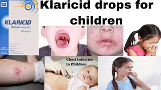 Klaricid drops  Clarithromycin drops  benefitshow to usedoseside effects [upl. by Barrow]