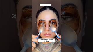 Remove Dark Circles Naturally At Home In 1DayUnderEye Dark Circles Remove Homeremedy dark shorts [upl. by Bissell]