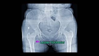 Pelvis X ray Anatomy in 30 second shortsvideo [upl. by Areht]