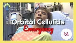 Orbital Cellulitis Emergency [upl. by Lleinad]