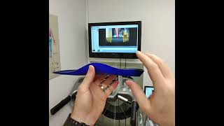 Plantar fasciitis treatment with a soft orthotic insole to limit over pronation [upl. by Dumah]