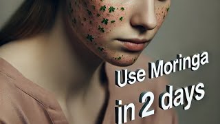 🌿 MORINGA NATURAL RELIEF FOR SKIN RASHES 🌱 [upl. by Seema]