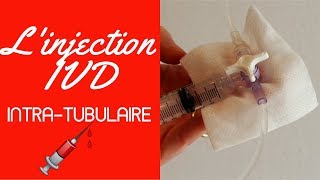 Injection IVD intra tubulaire [upl. by Norry]