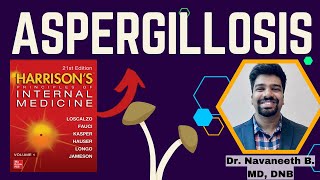 ASPERGILLOSIS  Pathogenesis  Clinical Features  Diagnosis  Treatment  Harrison [upl. by Gregoor589]