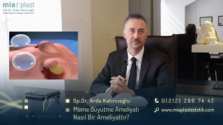 Meme Büyütme Ameliyatları  Op Dr Arda Katırcıoğlu [upl. by Idolah]