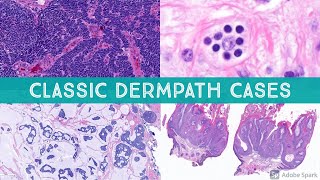 Classic Dermatopathology Cases from the Head amp Neck [upl. by Jessica]