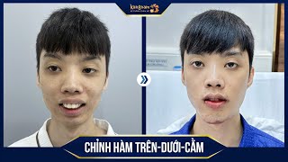 CẢNH BÁO Bạn sẽ không tin vào sự biến đổi gương mặt chỉ sau 24 giờ [upl. by Jabon]