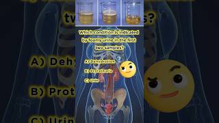 Foamy Urine Discover What It Could Mean urine test biology short [upl. by Eelrac]