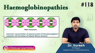 118 Haemoglobinopathies  Medical Biochemistry  USMLE FMGE and NEET PG [upl. by Barnaba86]