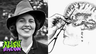 The Horrific Life of Rosemary Kennedy [upl. by Belding383]