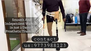 Hip Disarticulation Prosthesis  जांग से कटे मरीज के लिए नकली टांग  जांग से कटे मरीज का नकली पैर [upl. by Oraneg]