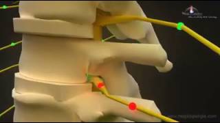 How Chiropractic works [upl. by Darmit]