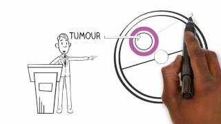 Basic sciences  Margins in tumour resection [upl. by Lucille430]