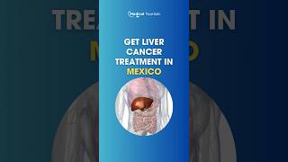 Find high quality liver cancer treatment in Mexico ✈️ – Medical Tourism cancer mexico [upl. by Yelnikcm]