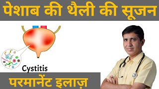 Cystitis  Bladder Pain Pesab Ki Theli Ki Sujan  Pesab Khulkar Nahi Aana  Homeopathy For Cystitis [upl. by Attelocin]