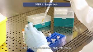 Rapid Test CerTest SARS CoV 2 Professional Use [upl. by Kruse]