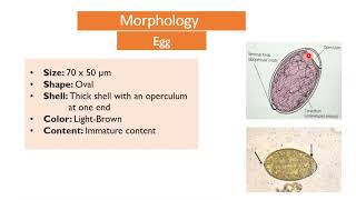 MED Level 2 GIT Diphyllobothrium latum 2 [upl. by Barstow]