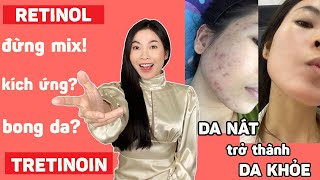 Sử dụng hiệu quả RETINOL và TRETINOIN không gây kích ứng từ một nền da từng hư tổn tan nát ❗ [upl. by Allemahs]