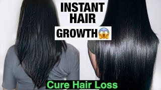 DIY HAIR GROWTH  HOW TO GROW LONGER THICKER HAIR 100 WORKS  STOP HAIR LOSS  Naturally amp Fast [upl. by Baptlsta]