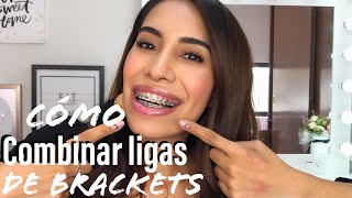 TIPS PARA ELEGIR LIGAS DE BRACKETS 🔥 cómo combinar tus brackets [upl. by Yenduhc]