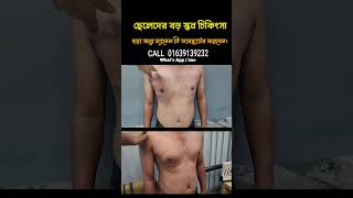 Gynecomastia Surgery Cost [upl. by Yi889]