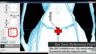 Motorized Stereotaxic 5 Setting the Zero Reference Point [upl. by Ynabla]