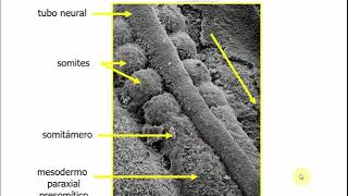 Histología CBCC5  T18a  Embrión somítico Desarrollo del sistema músculo esquelético parte 1 [upl. by Silda]