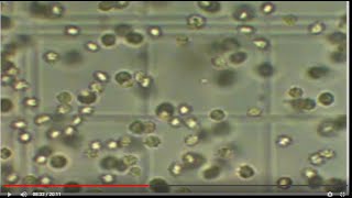 How to count Rbcs amp Wbcs content using Hemocytometer [upl. by Deeann]