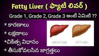 Fatty Liver Pathophysiology [upl. by Erdried]