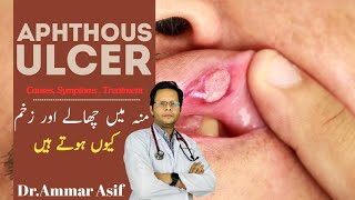 Why You Keep Getting Mouth Sores Aphthous Ulcers [upl. by Cari]