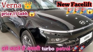 Hyundai Verna Facelift 160BHP😱🚀 मात्र 11 लाख में hyundaicars vernafacelift vernacar premcaryt [upl. by Bonnibelle360]