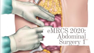 eMRCS 2020 Abdominal Surgery 1 [upl. by Jeanine]