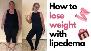 How to Lose Weight With Lipedema [upl. by Dyson]