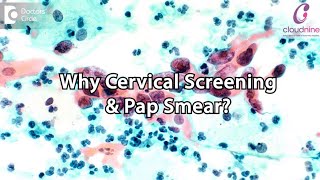 What is Cervical Screening What can Pap Smear detect DrRajendra Motilal Saraogi of C9 Hospitals [upl. by Haliled]