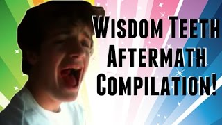 Wisdom Teeth Aftermath After Wisdom Teeth Removal Dentist Compilation Hilarious [upl. by Attelra612]