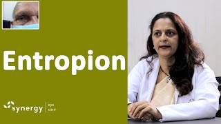 Entropion What You Should Know Causes Symptoms and Treatment [upl. by How733]