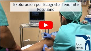 TENDINITIS CRÓNICA DEL ROTULIANO ECOGRAFÍA DE NEOVASCULARIZACIÓN [upl. by Herrera]