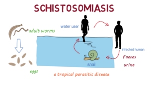 Schistosomiasis Bilharzia– an overview [upl. by Aidnyl]