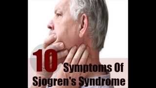 10 Major Symptoms Of Sjogrens Syndrome [upl. by Aryad]