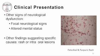 1 Overview meningitis and encephalitis [upl. by Adnicaj]