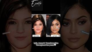 What work do you think Kylie Jenner has got doneDid Kylie Jenner have Face Surgerybeauty [upl. by Saile]