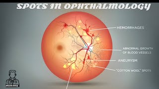 Spots in Ophthalmology  Medicinoz App [upl. by Sidonnie]