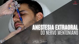 Anestesia extraoral do nervo mentoniano [upl. by Dunseath821]