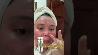 Sumifun Psoriasis Cream 390₱ [upl. by Newmann]