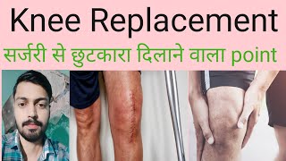 Knee pain treatment at home in hindi  Accupressure for pain relief। [upl. by Aryahay952]