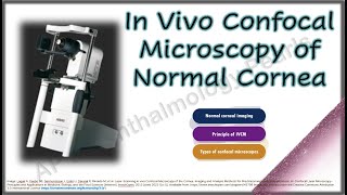 In Vivo Confocal Microscopy of Normal Cornea [upl. by Alston]