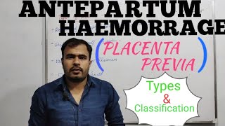 ANTEPARTUM HAEMORRHAGE  PLACENTA PREVIA  APH  PART 1  BY AMAN DAHIYA [upl. by Aneed]